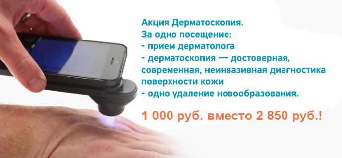 Как избавиться от бородавок на ступне