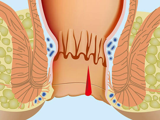 Зуд половых губ - причины возникновения вульвита, его профилактика и лечение