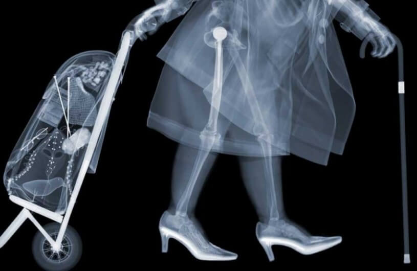 Как часто можно делать рентген ребенку и взрослому, сколько раз в год можно  делать рентген легких?